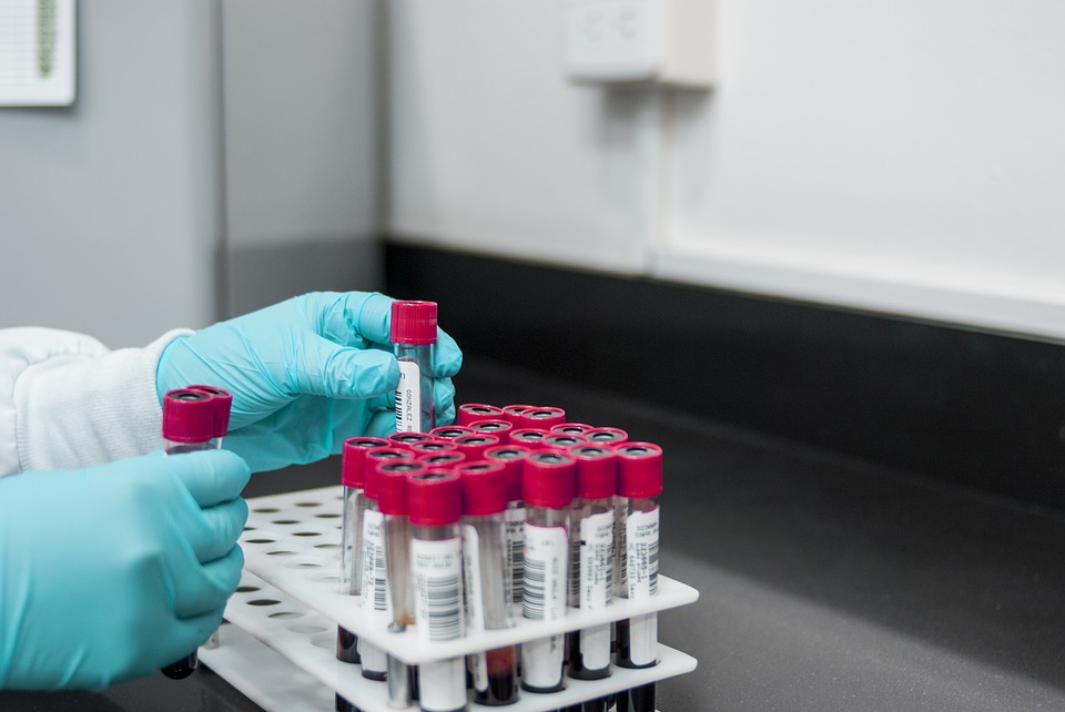 kratom drug test